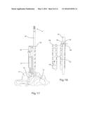 Drilling/Milling Guide and Keel Cut Preparation System diagram and image