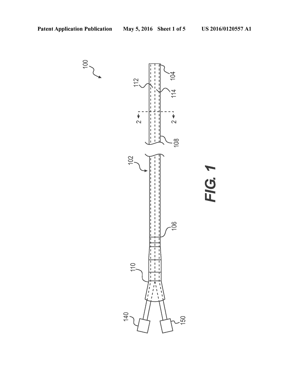 MEDICAL DEVICE FOR REMOVING PARTICLES - diagram, schematic, and image 02