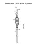 METHOD AND APPARATUS FOR CENTERING A MICROCATHETER WITHIN A VASCULATURE diagram and image