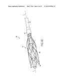 METHOD AND APPARATUS FOR CENTERING A MICROCATHETER WITHIN A VASCULATURE diagram and image