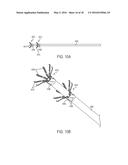 METHOD AND APPARATUS FOR CENTERING A MICROCATHETER WITHIN A VASCULATURE diagram and image