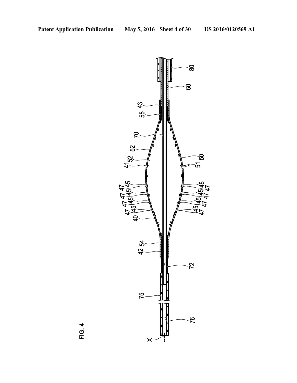 MEDICAL DEVICE AND TREATMENT METHOD - diagram, schematic, and image 05