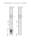 MEDICAL DEVICE AND TREATMENT METHOD diagram and image