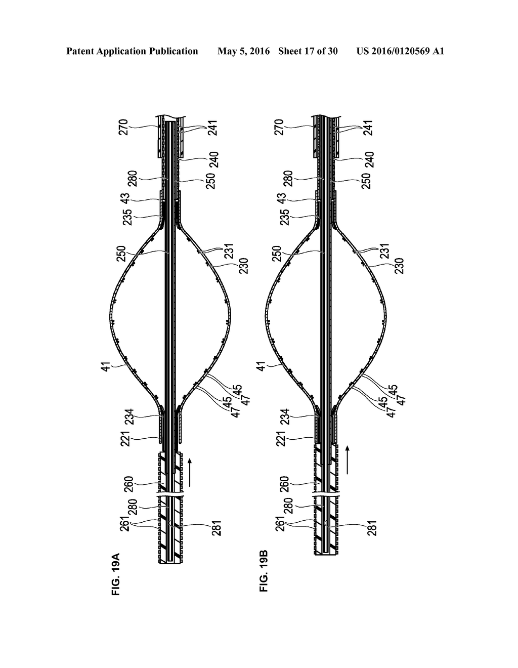 MEDICAL DEVICE AND TREATMENT METHOD - diagram, schematic, and image 18