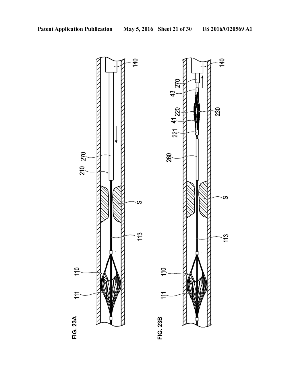 MEDICAL DEVICE AND TREATMENT METHOD - diagram, schematic, and image 22