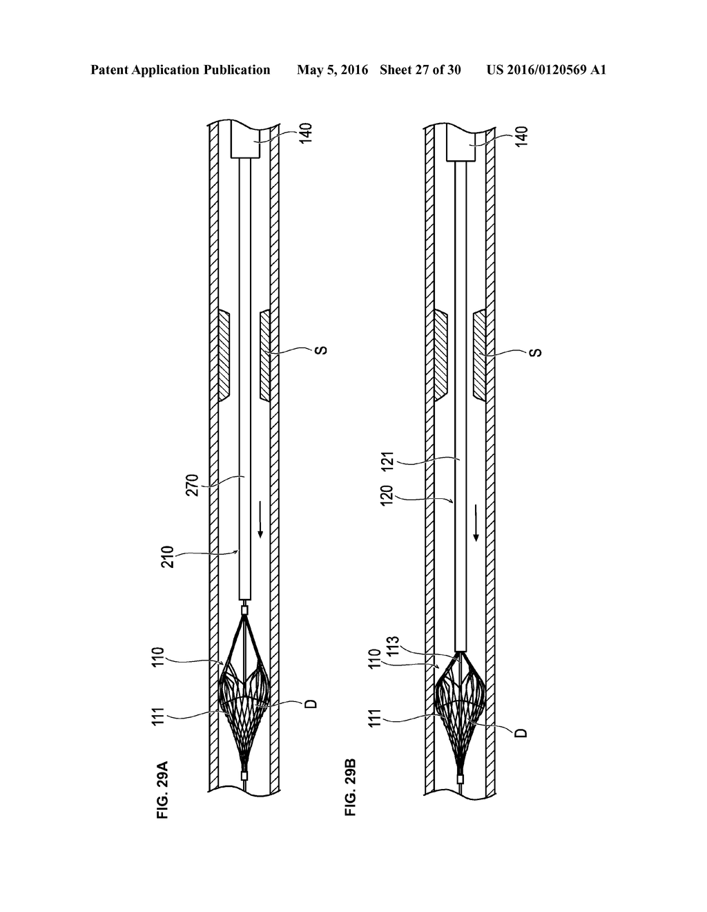 MEDICAL DEVICE AND TREATMENT METHOD - diagram, schematic, and image 28