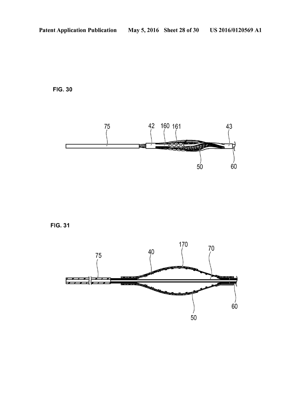 MEDICAL DEVICE AND TREATMENT METHOD - diagram, schematic, and image 29