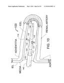 TRANSVASCULAR METHODS OF TREATING EXTRAVASCULAR TISSUE diagram and image