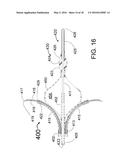 TRANSVASCULAR METHODS OF TREATING EXTRAVASCULAR TISSUE diagram and image