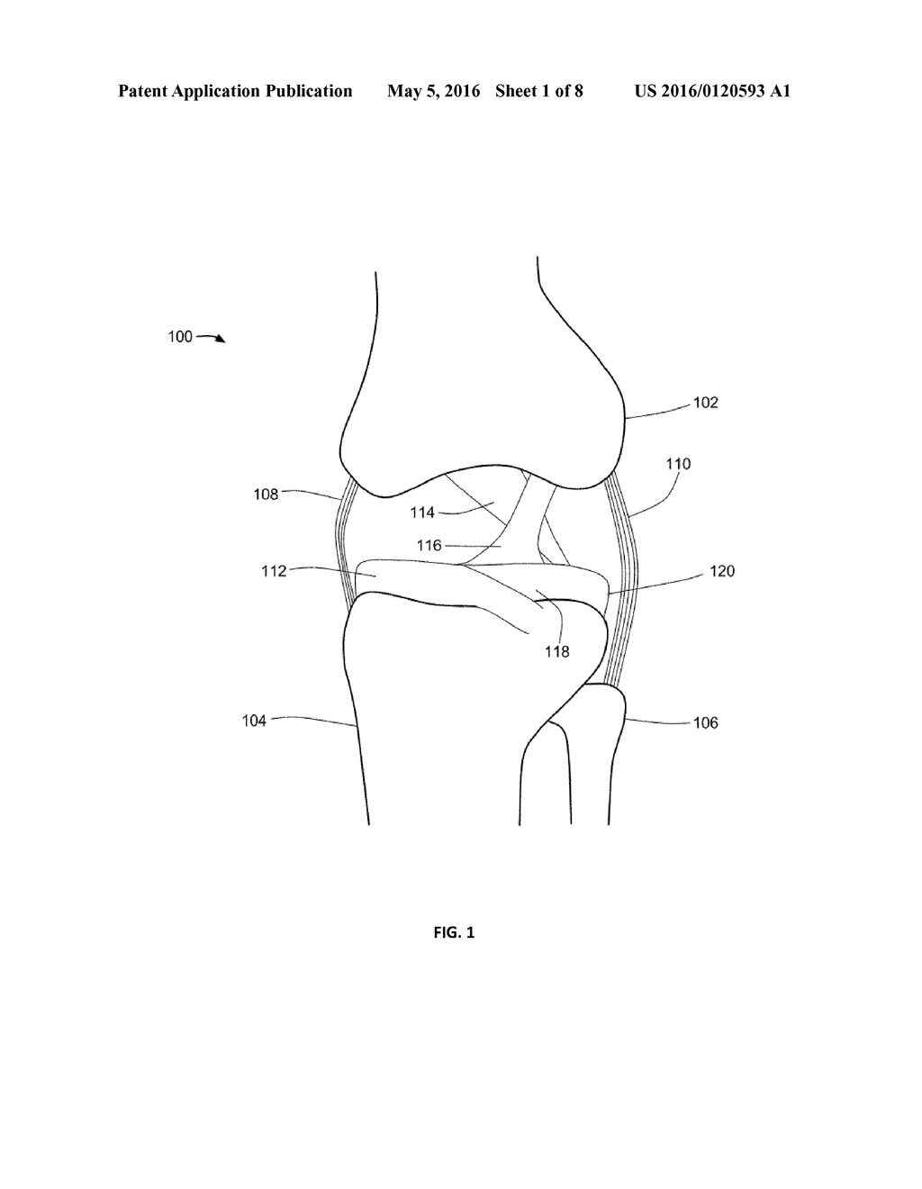 THERMALLY TREATING TORN TISSUE - diagram, schematic, and image 02