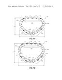HEART AND PERIPHERAL VASCULAR VALVE REPLACEMENT IN CONJUNCTION WITH A     SUPPORT RING diagram and image