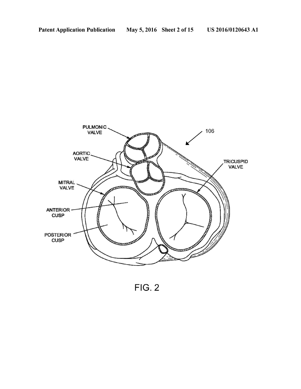 TRANSCATHETER CARDIAC VALVE PROSTHETIC - diagram, schematic, and image 03