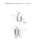 Total Knee Arthroplasty System and Method diagram and image