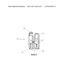 Total Knee Arthroplasty System and Method diagram and image