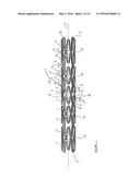 STENT WITH ALTERNATING AMPLITUDES diagram and image