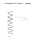 STENT WITH ALTERNATING AMPLITUDES diagram and image