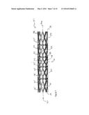 STENT WITH ALTERNATING AMPLITUDES diagram and image