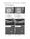 USE OF PEDF IN AN ENCAPSULATED CELL-BASED DELIVERY SYSTEM diagram and image