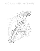 SEE-THROUGH REDUCED-PRESSURE DRESSINGS AND SYSTEMS diagram and image