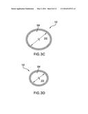 GARMENT SYSTEM INCLUDING AT LEAST ONE SENSOR AND AT LEAST ONE ACTUATOR     RESPONSIVE TO THE SENSOR AND RELATED METHODS diagram and image