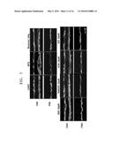 PHARMACEUTICAL COMPOSITION FOR TREATING DISEASE ASSOCIATED WITH     DEMYELINATION OF NEURONS AND METHOD OF USING THE PHARMACEUTICAL     COMPOSITION diagram and image