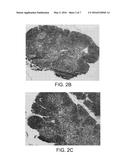 Thymic Regeneration diagram and image