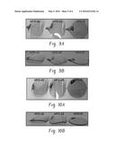 POLYCARBONATE COPOLYMER COMPOSITIONS FOR FORMING MOLDED MEDICAL ARTICLES     WITH THIN WALLS diagram and image