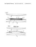 Antiadhesive Kit and Method of Adhesion Prevention diagram and image