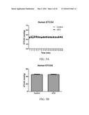 High Frequency Airway Oscillation For Internal Airway Vibration diagram and image