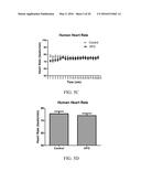 High Frequency Airway Oscillation For Internal Airway Vibration diagram and image