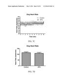 High Frequency Airway Oscillation For Internal Airway Vibration diagram and image