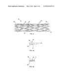 Swaged braided catheter and method of fabrication diagram and image