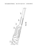 Progressive Flexibility Catheter Support Frame diagram and image