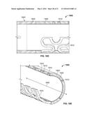 Progressive Flexibility Catheter Support Frame diagram and image