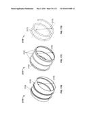 Progressive Flexibility Catheter Support Frame diagram and image