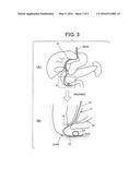 METHOD FOR INSERTING ENDOSCOPIC DEVICE INTO HOLLOW ORGAN diagram and image