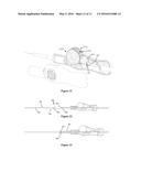 CATHETER PLACEMENT DEVICE diagram and image