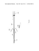 BIOPSY SPACER DEVICE AND METHOD OF OPERATION diagram and image