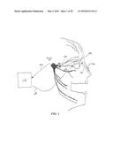 STIMULATION DEVICES AND METHODS FOR TREATING DRY EYE diagram and image