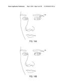 STIMULATION DEVICES AND METHODS FOR TREATING DRY EYE diagram and image