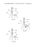 STIMULATION DEVICES AND METHODS FOR TREATING DRY EYE diagram and image