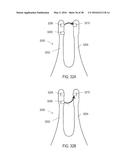 STIMULATION DEVICES AND METHODS FOR TREATING DRY EYE diagram and image