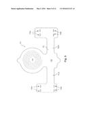 HYPERTENSION THERAPY IMPLANT APPARATUS diagram and image