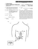 PAIRED STIMULATION PULSES BASED ON SENSED COMPOUND ACTION POTENTIAL diagram and image