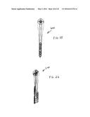 Reciprocating tube-shaking mechanisms for processing a material diagram and image