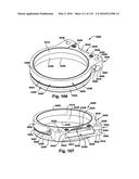 Power operated rotary knife diagram and image