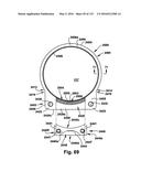 Power operated rotary knife diagram and image