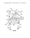 Power operated rotary knife diagram and image