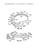 Power operated rotary knife diagram and image