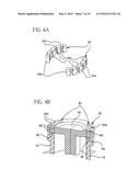 Medical Access Device diagram and image